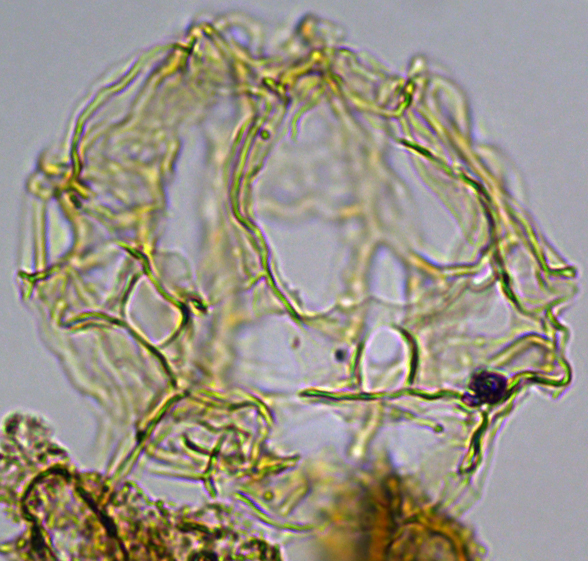 Chaenosphaerula sliwinskae Evitt27X21416240899a.jpg